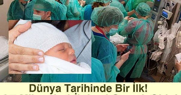 Dünya Tarihinde Bir İlk! 4,7 Milyarda 1 İhtimal Gerçek Oldu