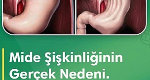 Karın şişliği neden olur?