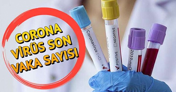 Corona virüsü son durum günlük tablosu! Dünyada ve Türkiyede korona virüs (koronavirüsü) ölüm ve vaka sayısı 