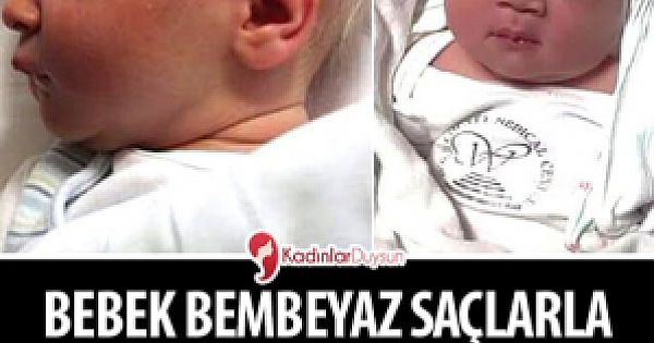 Bebek Bembeyaz Saçlarla Dünyaya Geldi – Doktor Gerçeği Açıklayınca Aile Şok Oldu