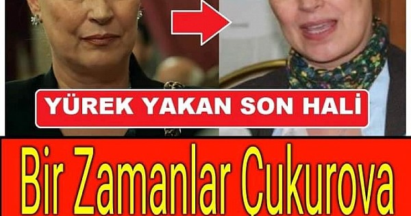 Bir umut ve moral hikayesi Kanseri yenen ünlü isimler