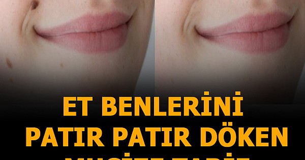 et benlerini patır patır döken mucize tarif!