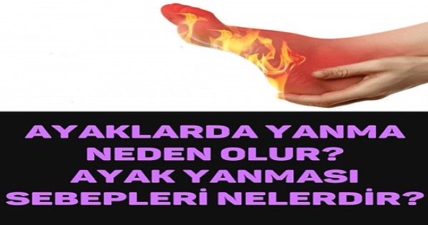 Ayaklarda Yanma Neden Olur – Ayak Yanması Sebepleri