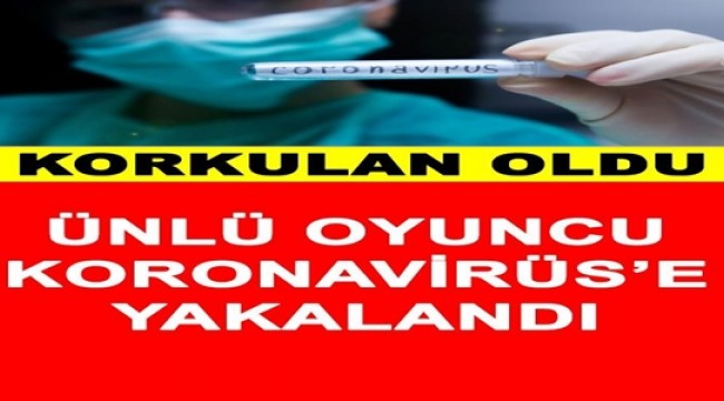 Ünlü Oyuncu Korona Virüsüne Yakalandı Karantinaya Alındı