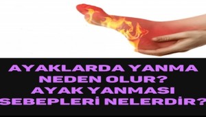 AYAKLARDA YANMA NEDEN OLUR, AYAK YANMASI SEBEPLERİ