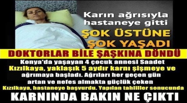 Karın Ağrısıyla Hastaneye Gitti..