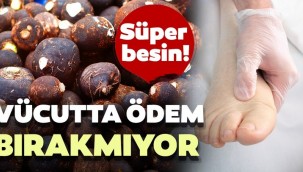 Mucize gıdalar! Vücutta ödem bırakmıyor